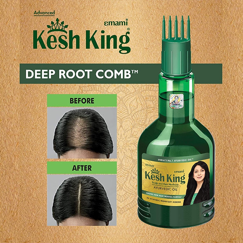 زيت شعر كش كنج Kesh king oil for hair growth حجم 100 مل + كريم Boro Plus هدية